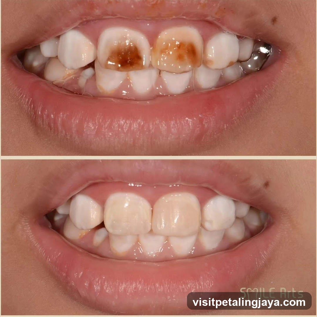 Dental Treatment Before and After