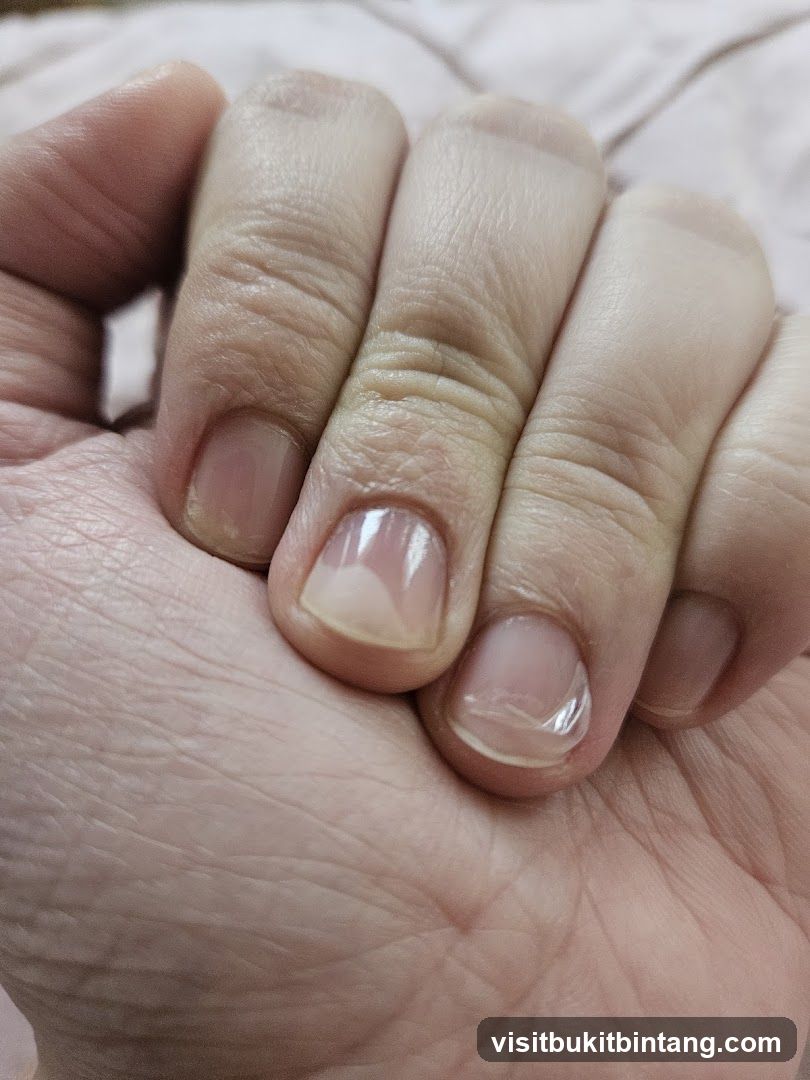 Fingernails