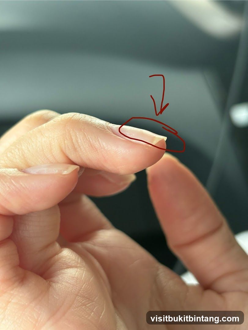 Close-up of a fingernail with a red circle and arrow